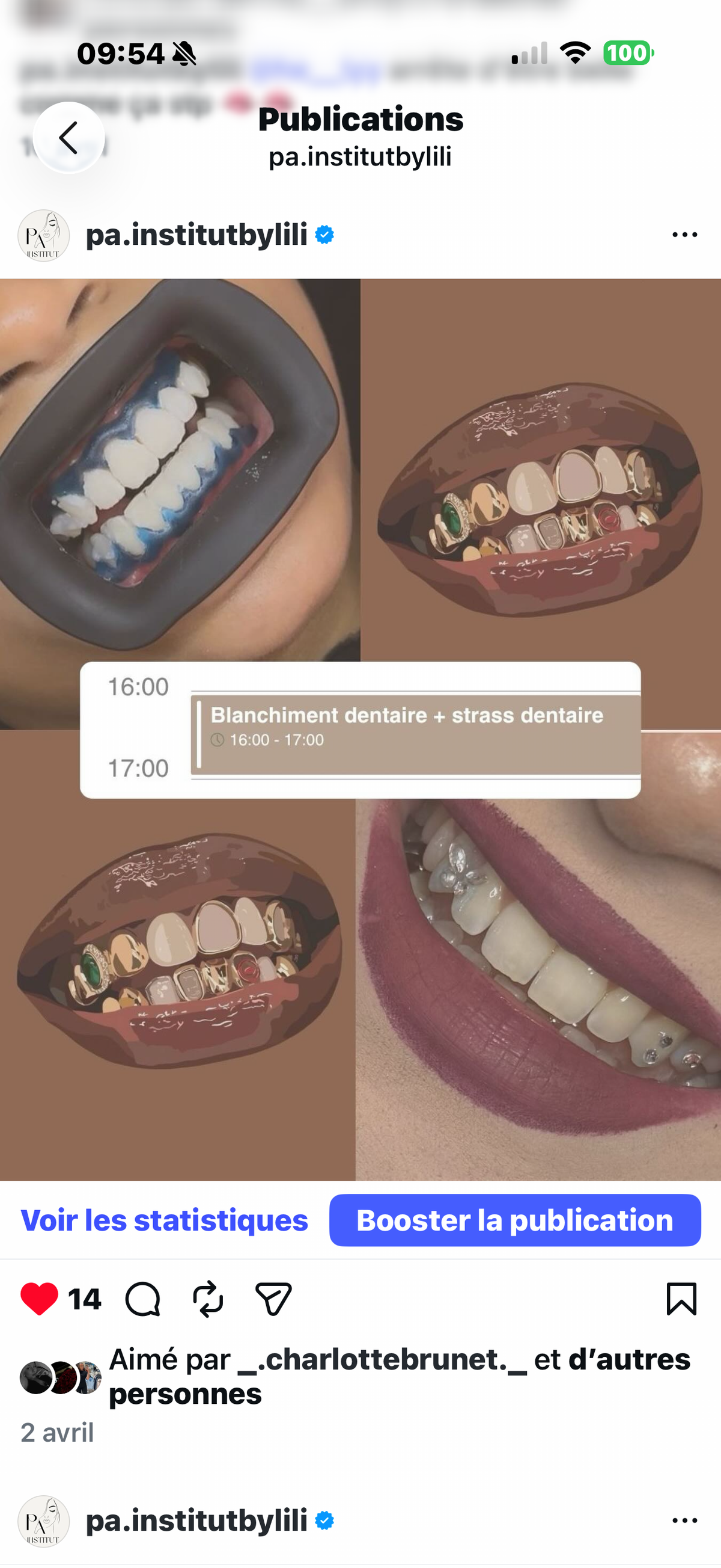 BEAUTÉ DU SOURIRE