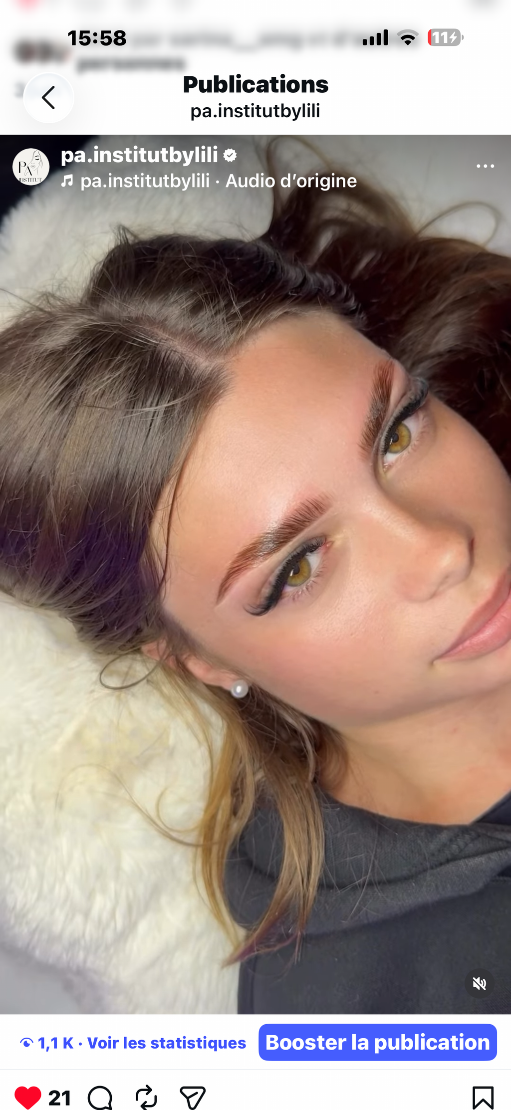 Browlift complet