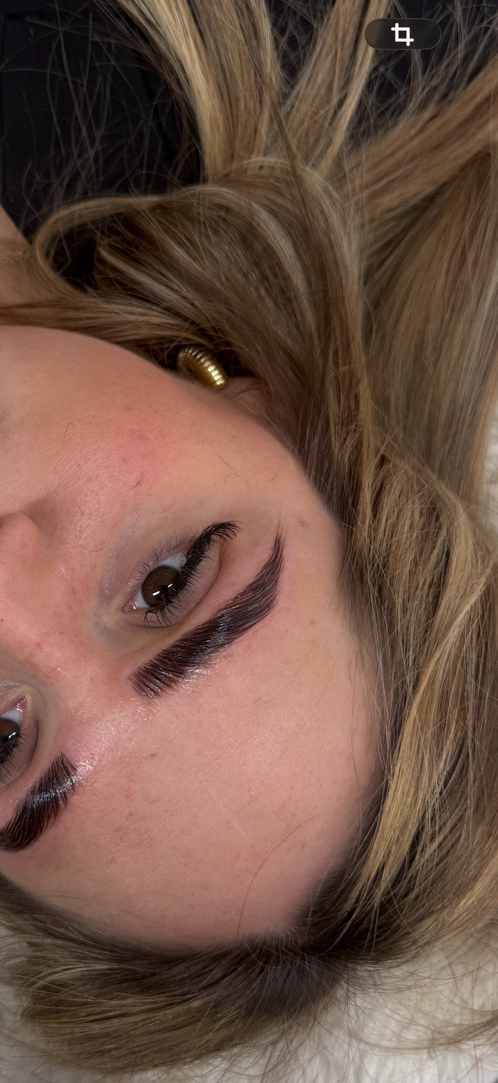 Browlift complet