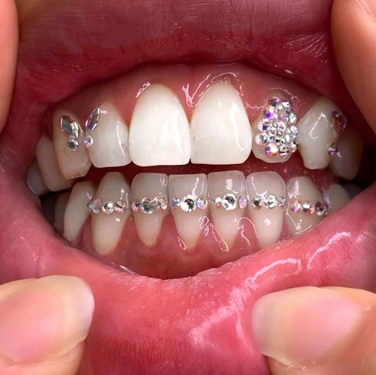 Strass dentaire